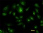 HGS Antibody (monoclonal) (M01)